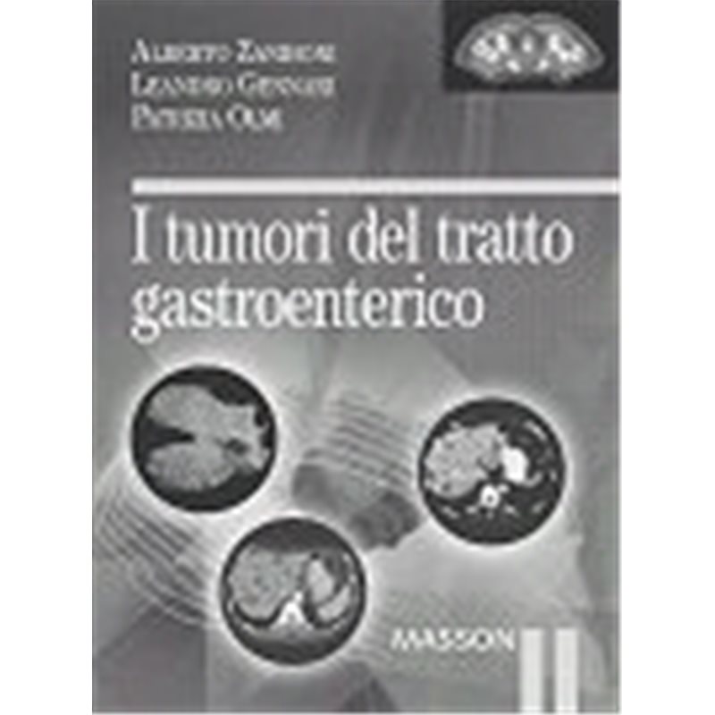 I tumori del tratto gastroenterico
